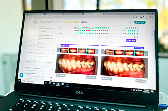 Orthodontics in Durham & Oxford NC - Wilson Orthodontics 12