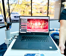 Surgical Orthodontics in Durham & Oxford, NC - Wilson Orthodontics 2