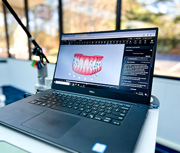 3d scanning in Durham & Oxford - Wilson Orthodontics 3